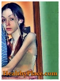 In questa foto di autolesionismo, una ragazza con anoressia si impegna anche in autolesionismo battendo e lividi parti del suo corpo