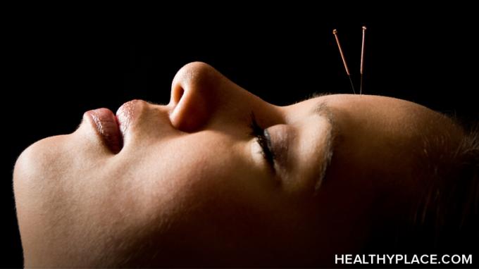 Il pannello NIH conclude che l'agopuntura nel trattamento del dolore cronico, della fibromialgia e di altre condizioni è ancora in sospeso.